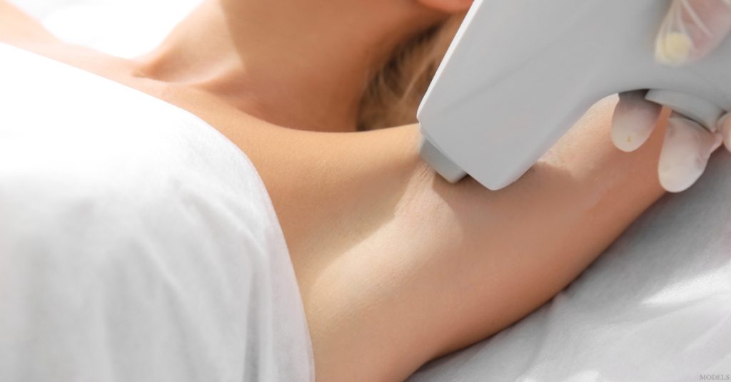 Woman receiving laser hair removal on her underarm (model)