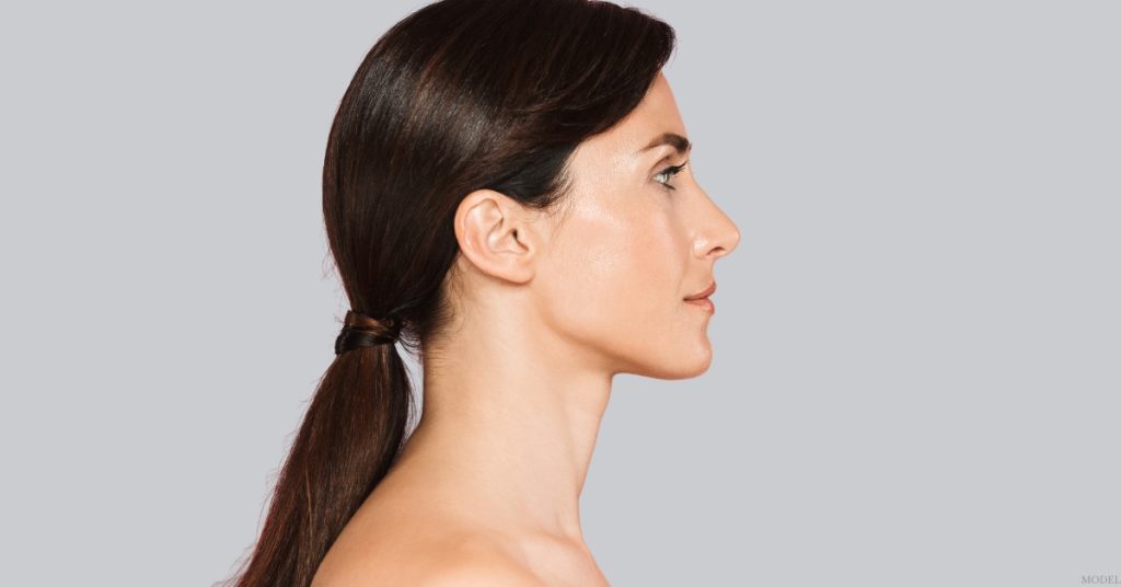 Side profile of a woman representing rhinoplasty results (model)