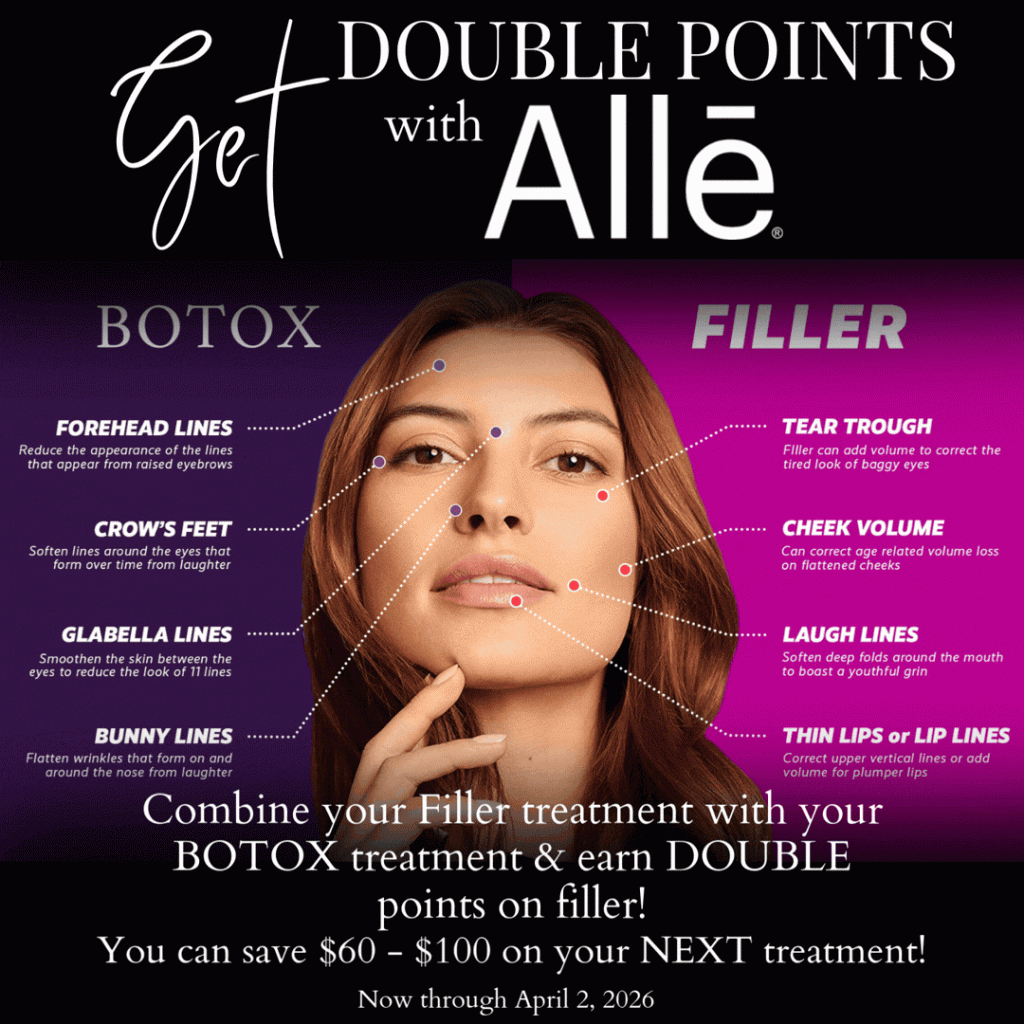alle double points