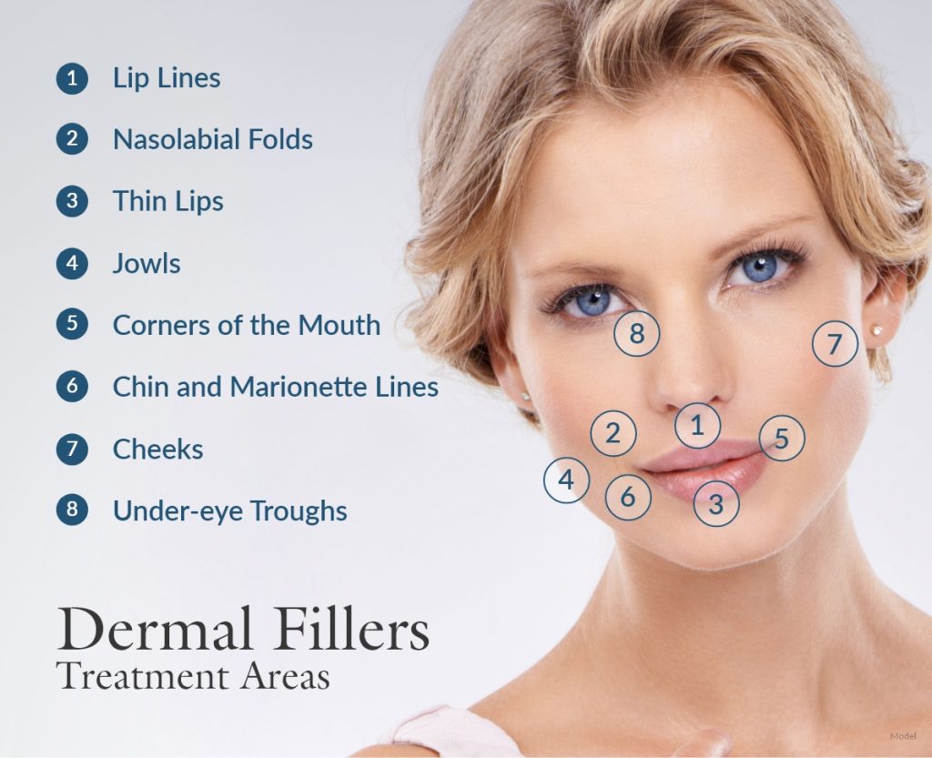 dermal fillers treatment areas