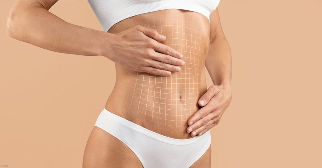 Woman's torso with a visual grid over the stomach (model)