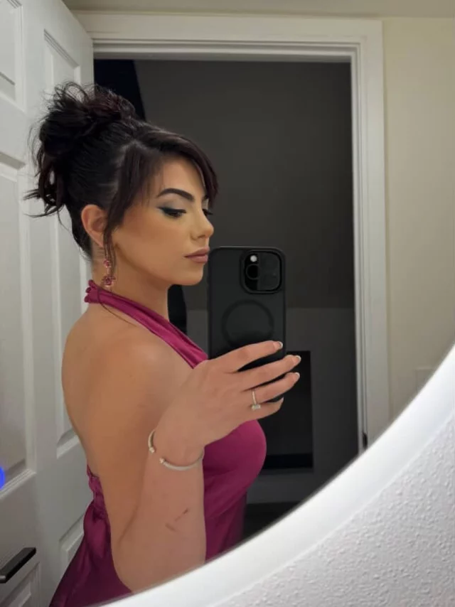 Confidence that lasts ✨ Two years post rhinoplasty and she’s more radiant than ever 💕

#rhinoplasty #nosebyvartany #naturalrhinoplasty #naturalrhinoplastylook