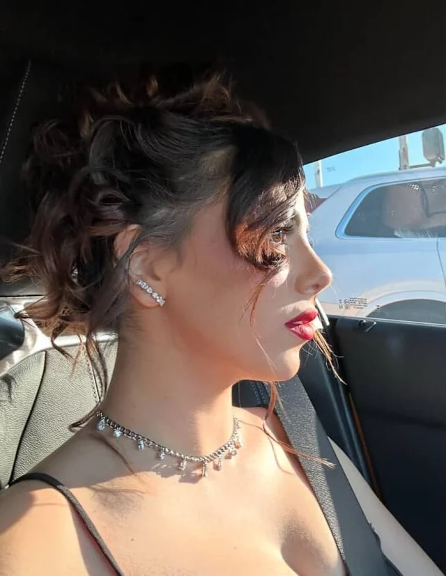 Subtle, natural refinement ✨
Our beautiful patient glowing after her rhinoplasty — designed for balance, harmony, and confidence from every angle.

📍Performed by Dr. Vartany
💻 www.vartany.com
📞 818-500-0823
📧 frontdesk@vartany.com
📍116 S Buena Vista St, Ste 300, Burbank, CA 91505

#Rhinoplasty #BurbankPlasticSurgery #FacialBalance #VartanyPlasticSurgery #naturalresults