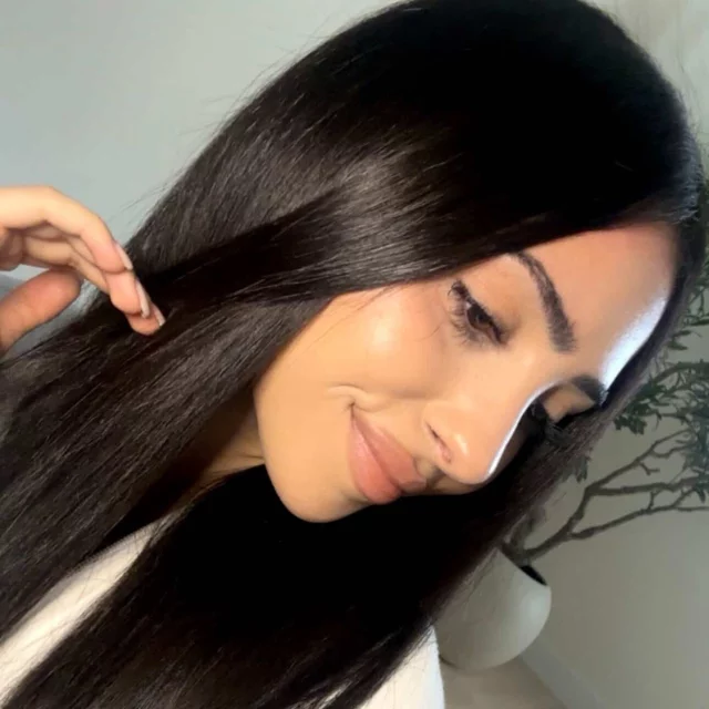 Our wonderful patient healing beautifully post rhinoplasty❤️ 

#rhinoplasty #burbankplasticsurgery #naturalnosejob