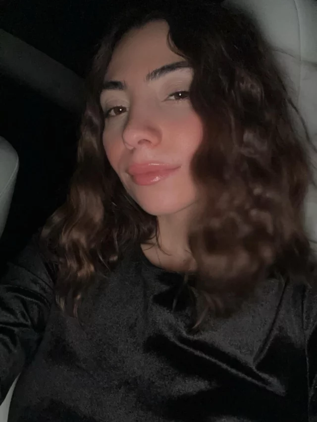 Our approach to rhinoplasty is never about changing who you are — it’s about elevating your natural beauty with precision, artistry, and intention. The goal is confidence that feels effortless, results that look timeless, and refinement that never overpowers.

Beautiful outcomes begin with thoughtful planning and end with results that feel authentic, elegant, and uniquely yours.

📍 Performed by Dr. Vartany
🌐 www.vartany.com
📞 818-500-0823
📧 frontdesk@vartany.com
📍 116 S Buena Vista St, Ste 300, Burbank, CA 91505

#NewYearNewNose #Rhinoplasty #NaturalRhinoplasty #FacialHarmony